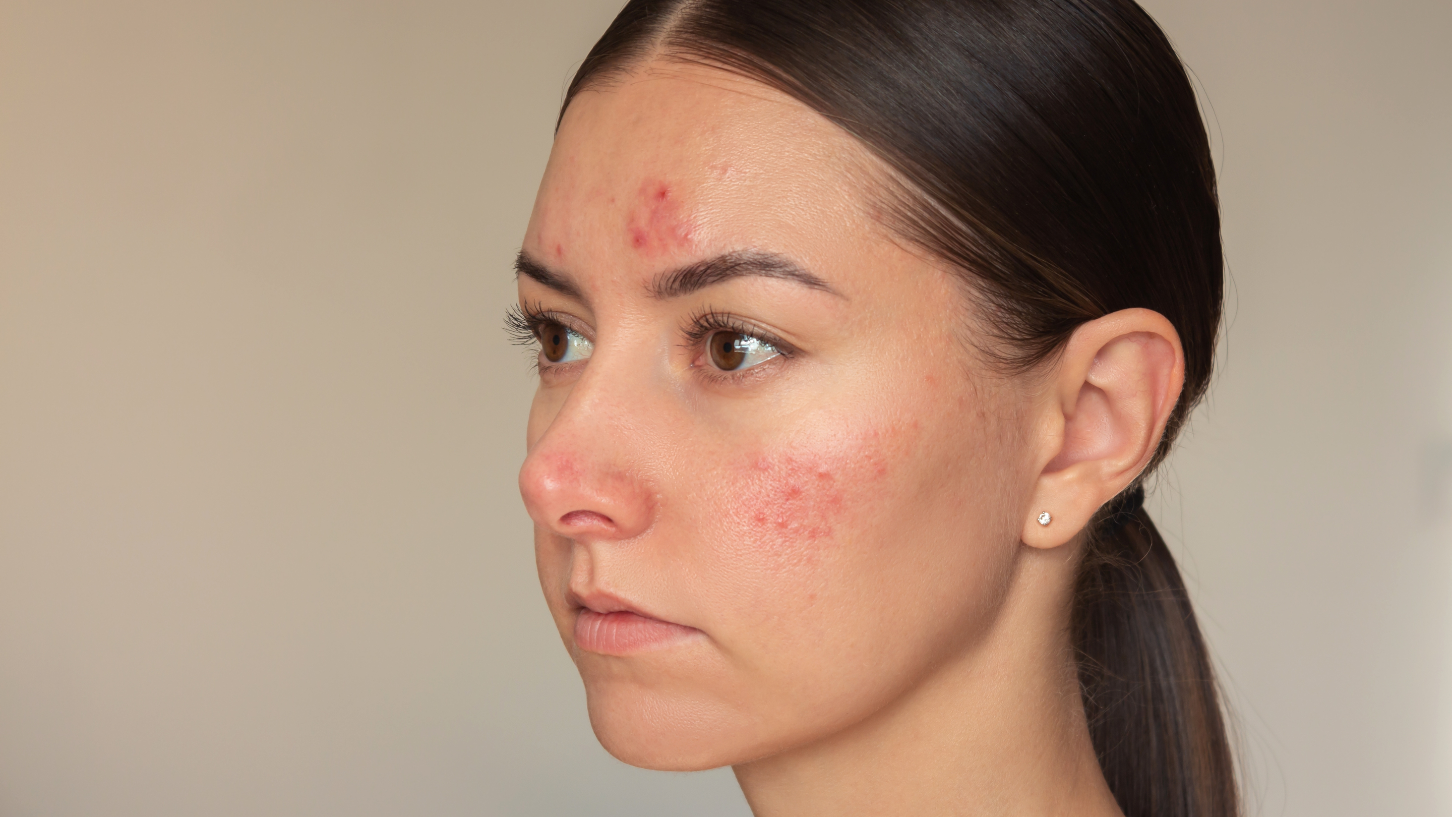 When Should You See a Dermatologist?