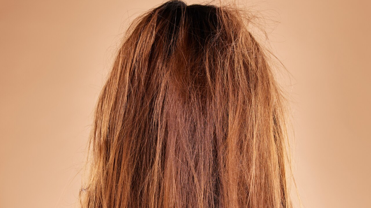 What Is Brittle Hair?