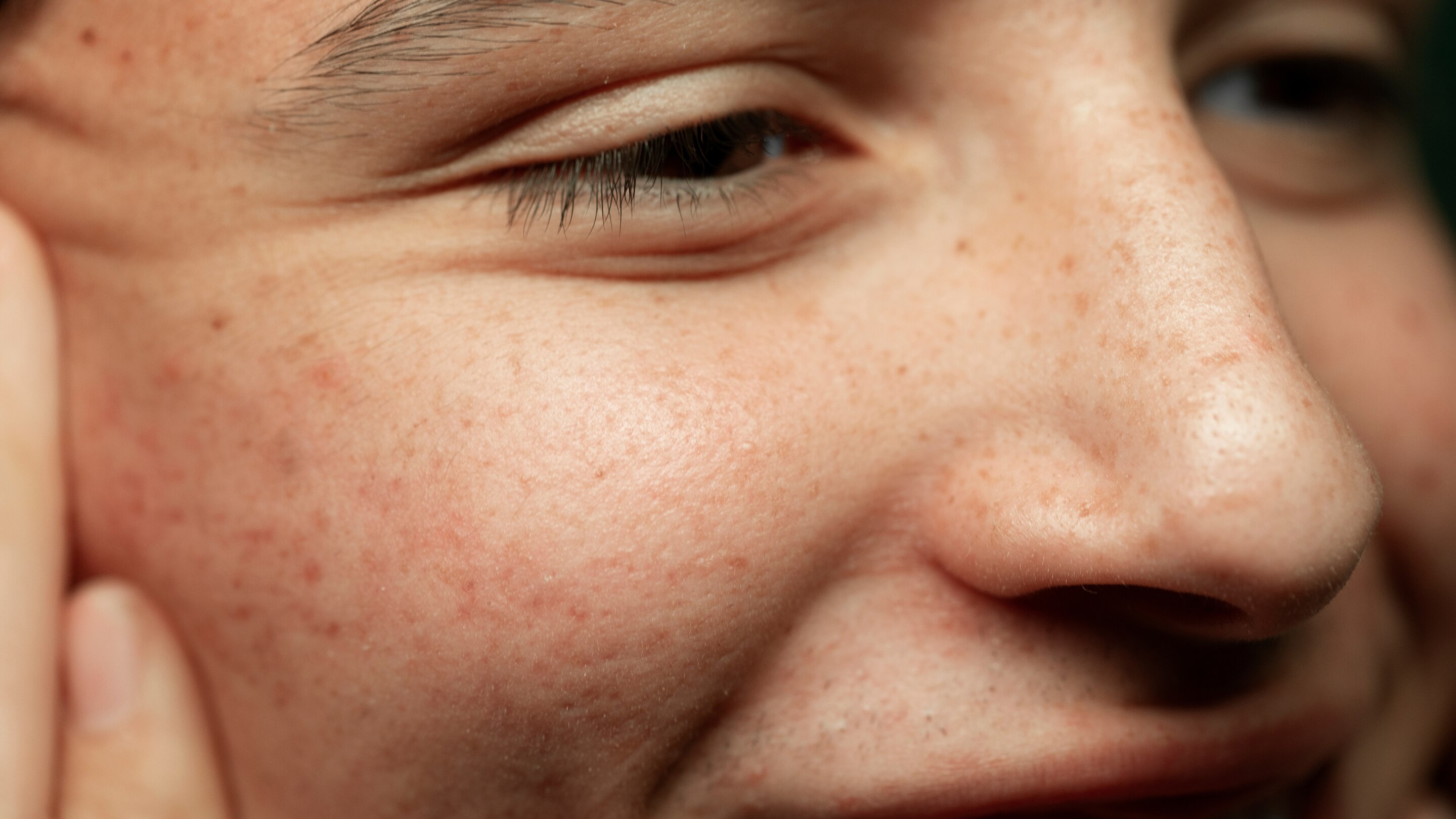 6. Improves Overall Skin Texture