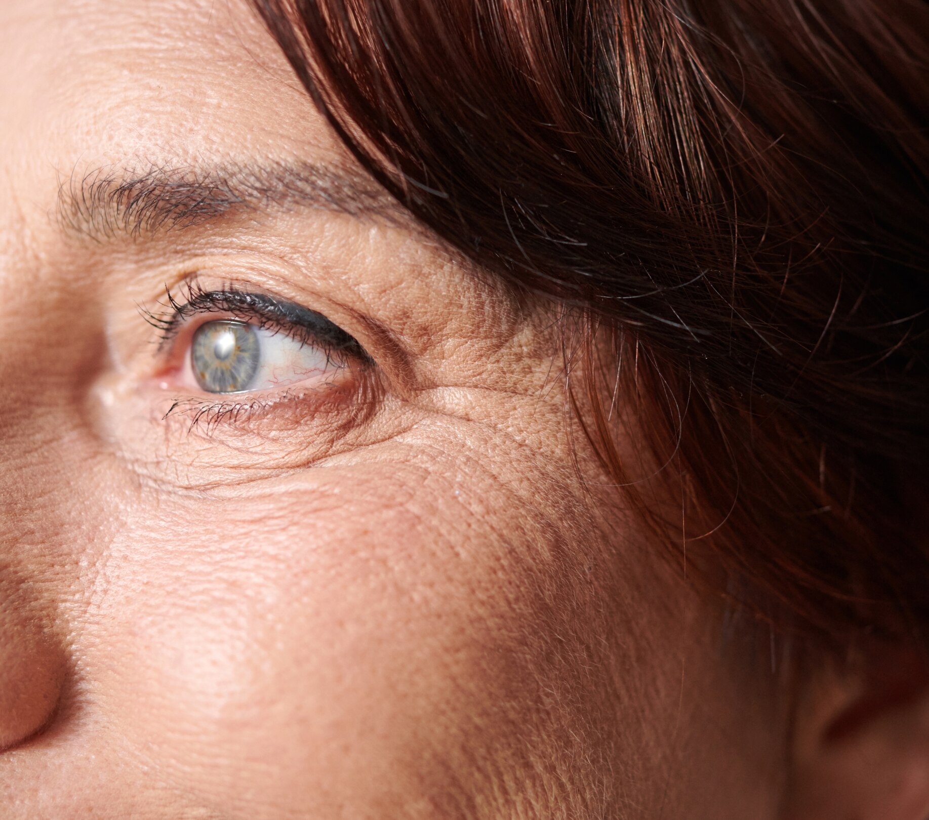 Image of Wrinkles on Face: Signs, Causes & Skincare Tips to Retain Youthful Glow