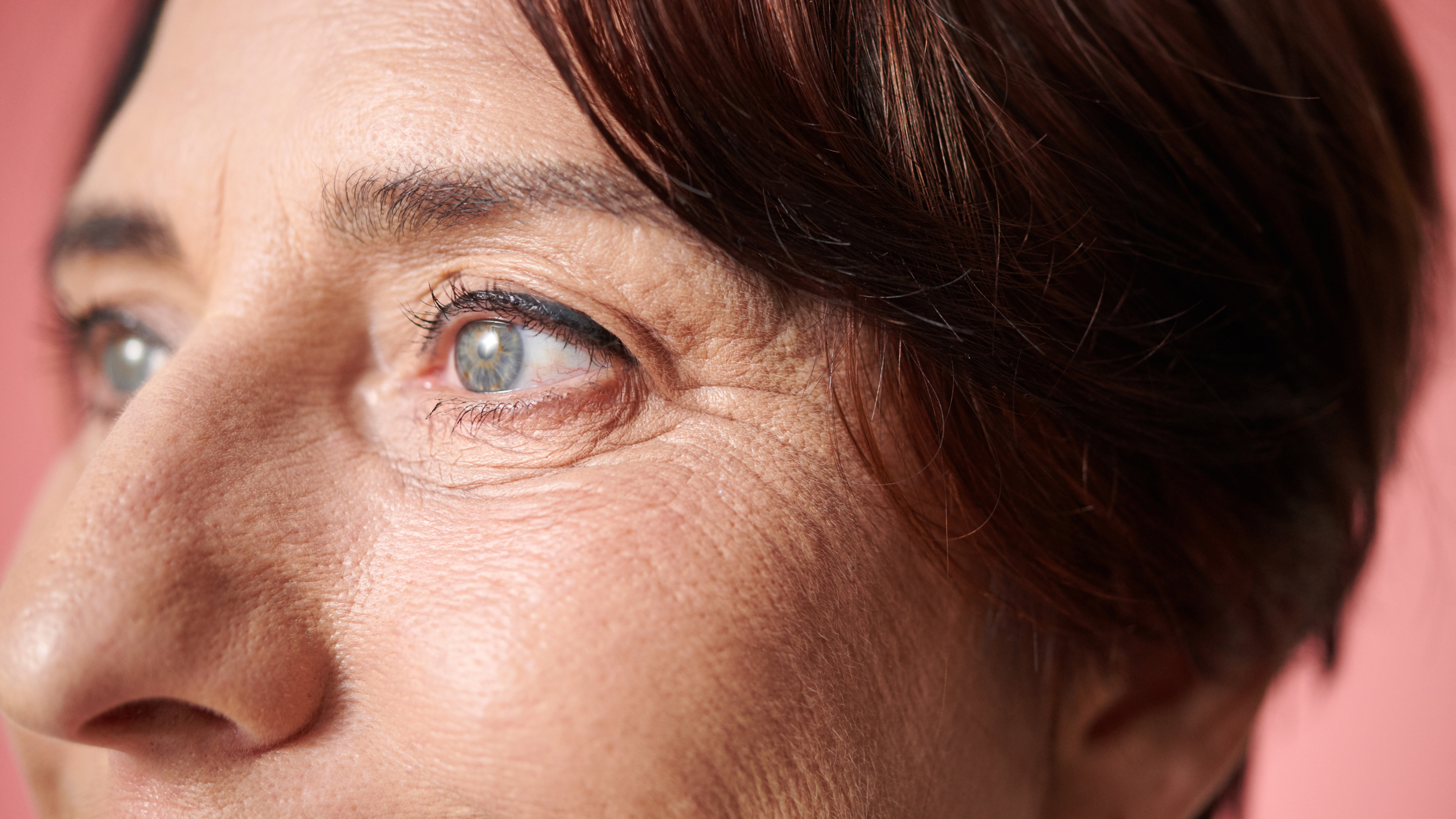 Wrinkles on Face Causes Treatment and Skincare Tips