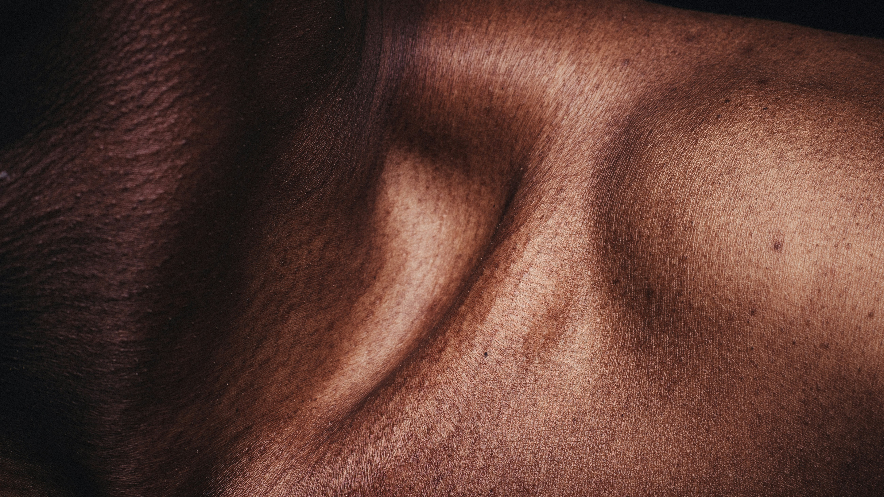 Why Indian skin is prone to pigmentation, and what actually fades it
