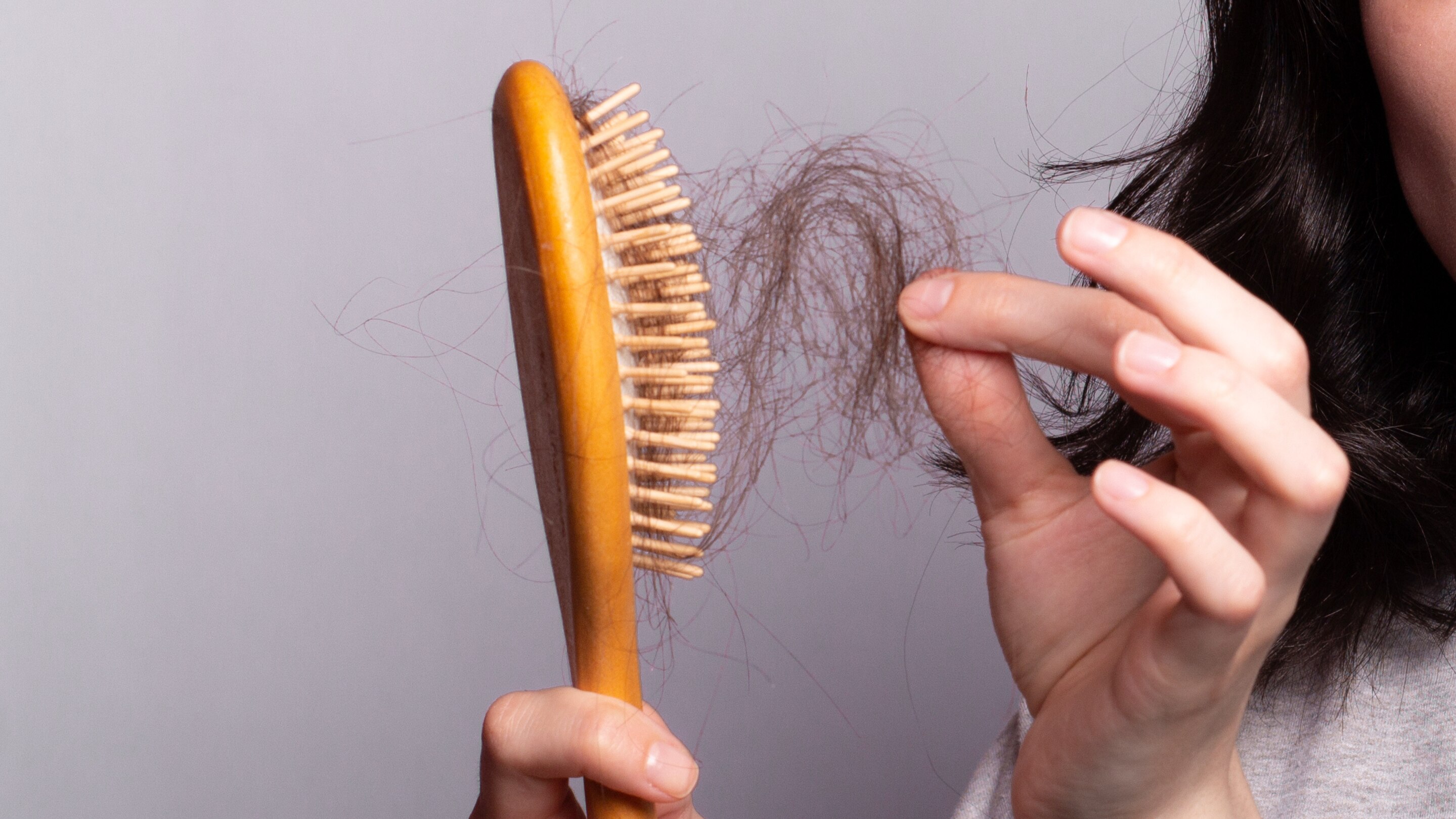 Early Signs of Receding Hairline
