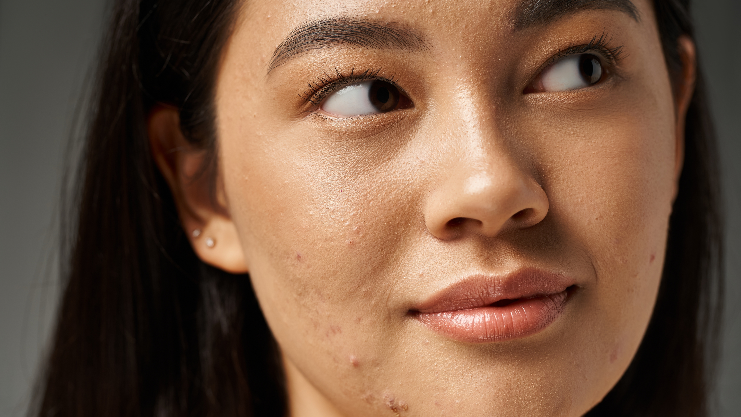 Treatments That Help to Remove Pimple