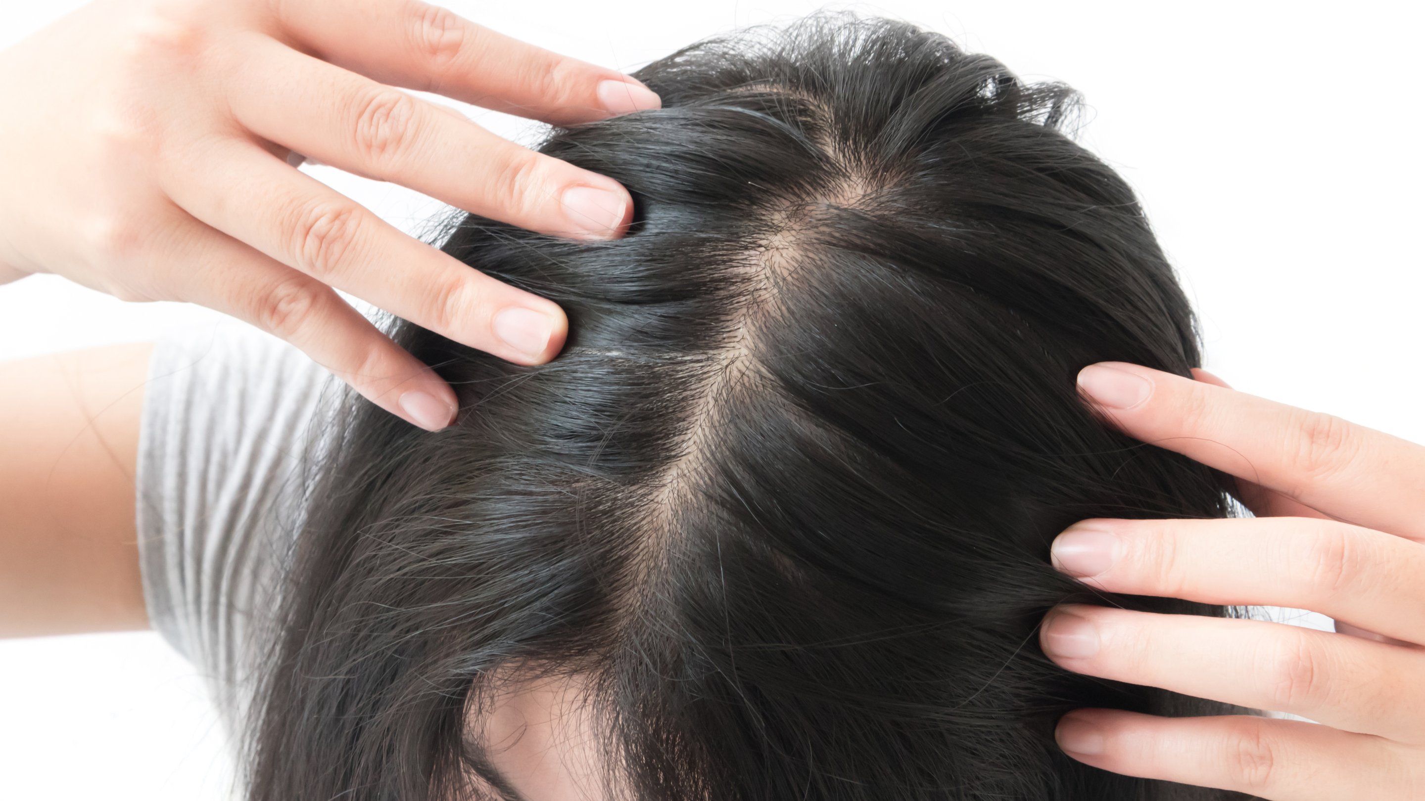 Oily Scalp with Dry Ends
