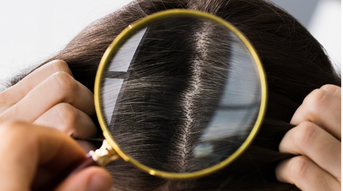 Postpartum Hair Fall Causes and Remedies