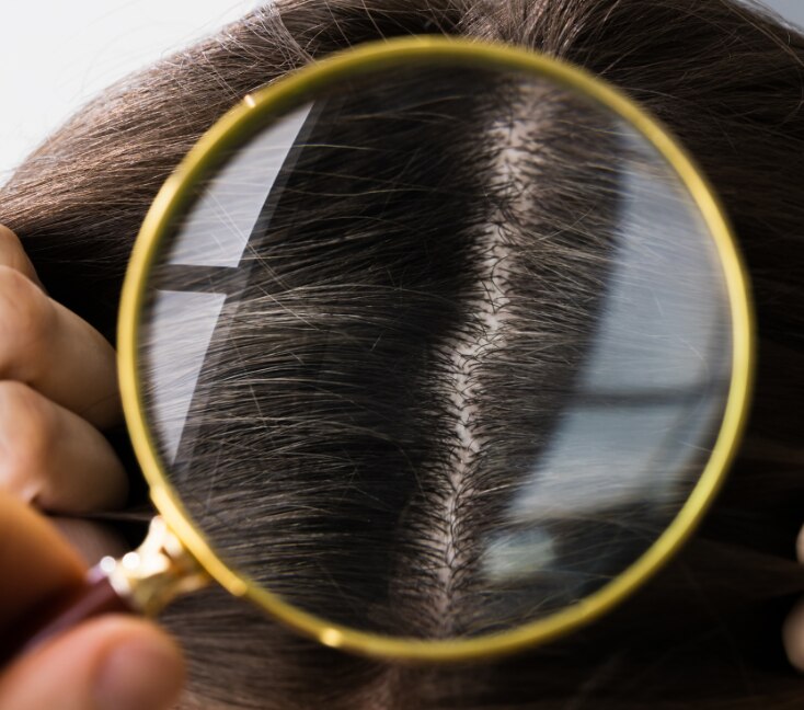 Image of Postpartum Hair Fall: Why It Happens & Remedies That  Actually Helps