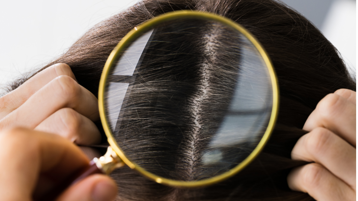 Postpartum Hair Fall Causes and Remedies