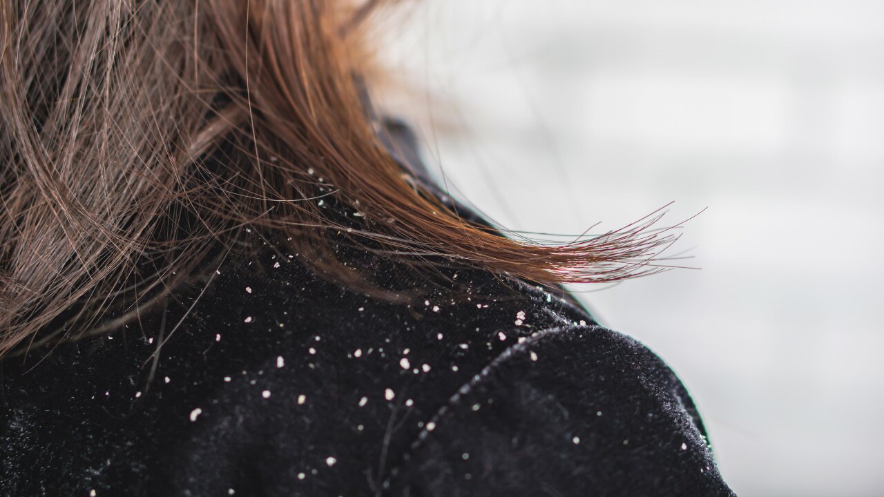 Helps Reduce the Appearance of Flakes