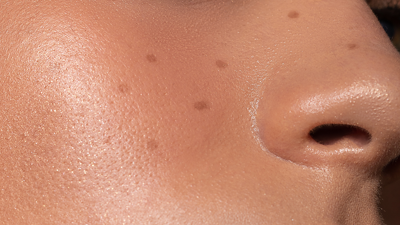 Improves skin texture