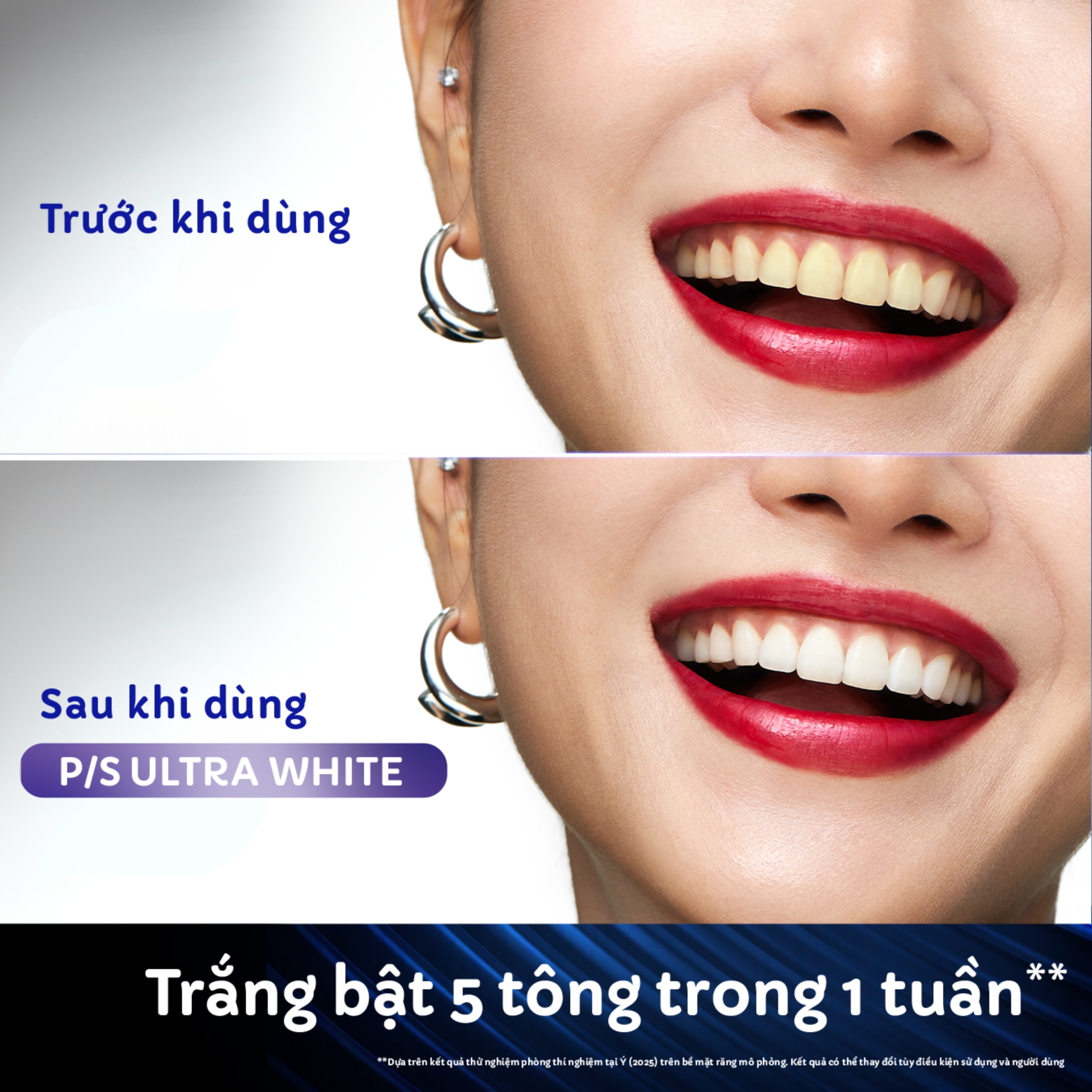 P/S Ultra White Ultimate Bright