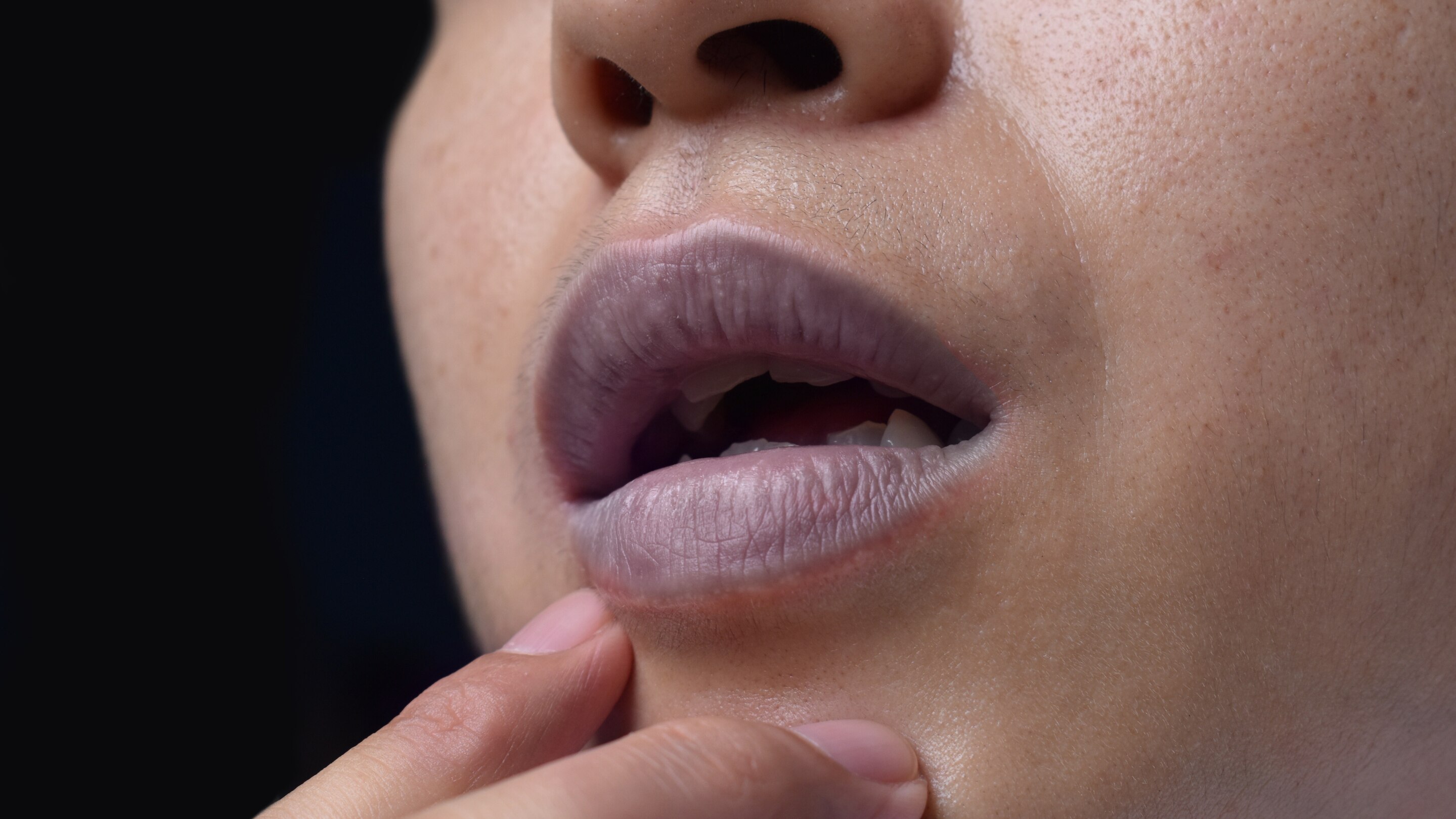 What Causes Dark or Pigmented Lips?