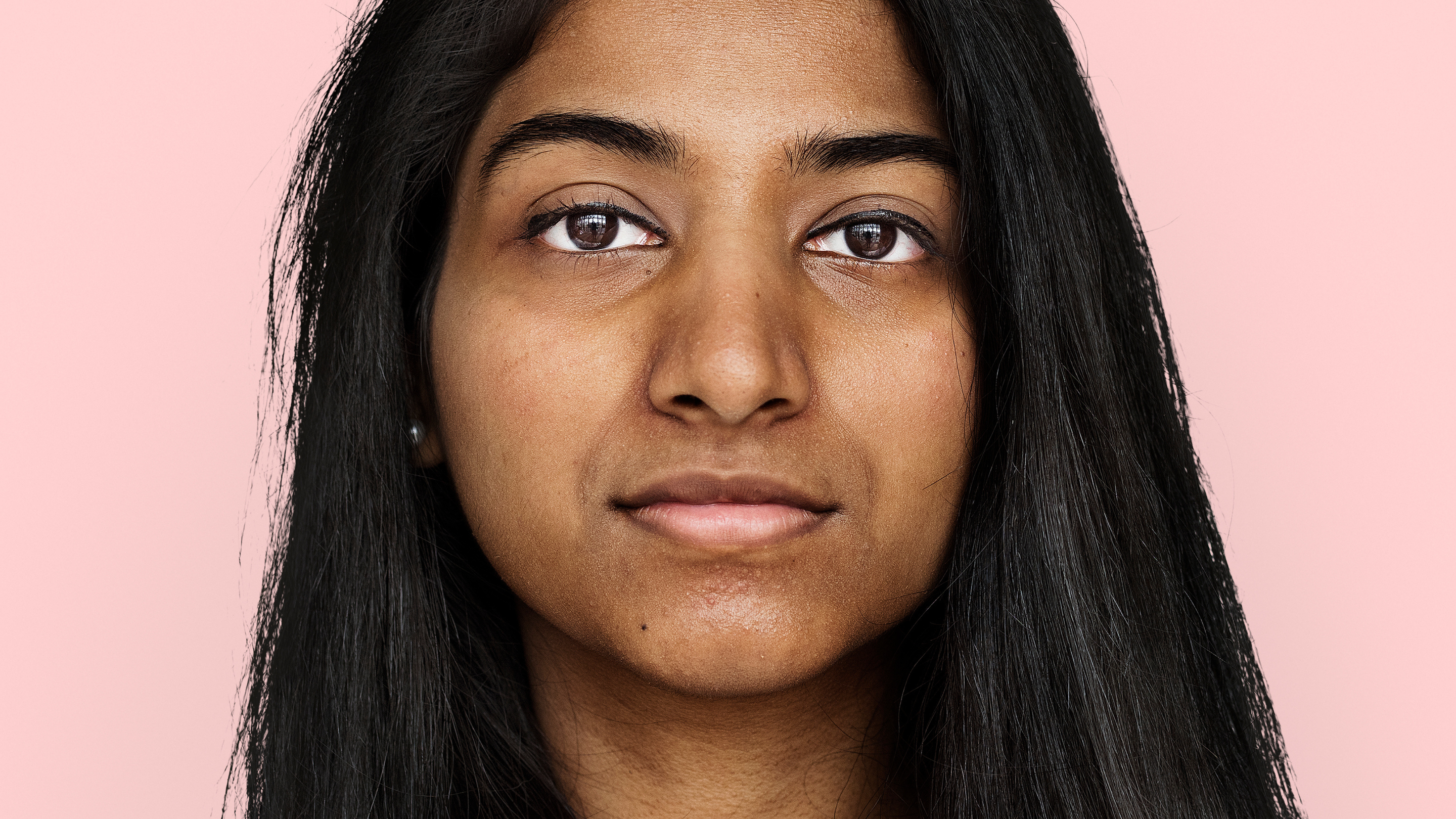 Vitamin B12 Deficiency and Skin Discolouration