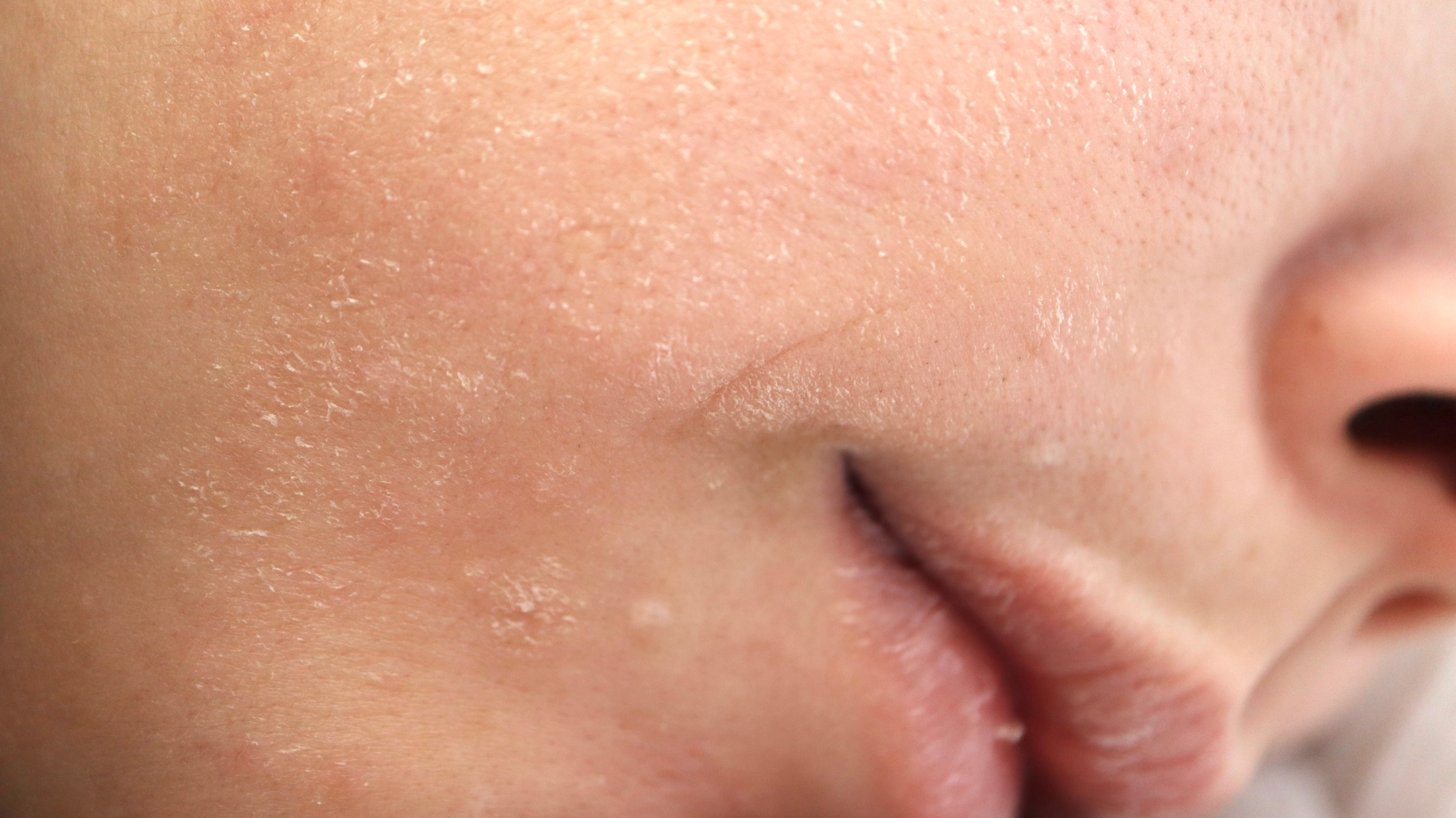 Helps remove surface build-up:
