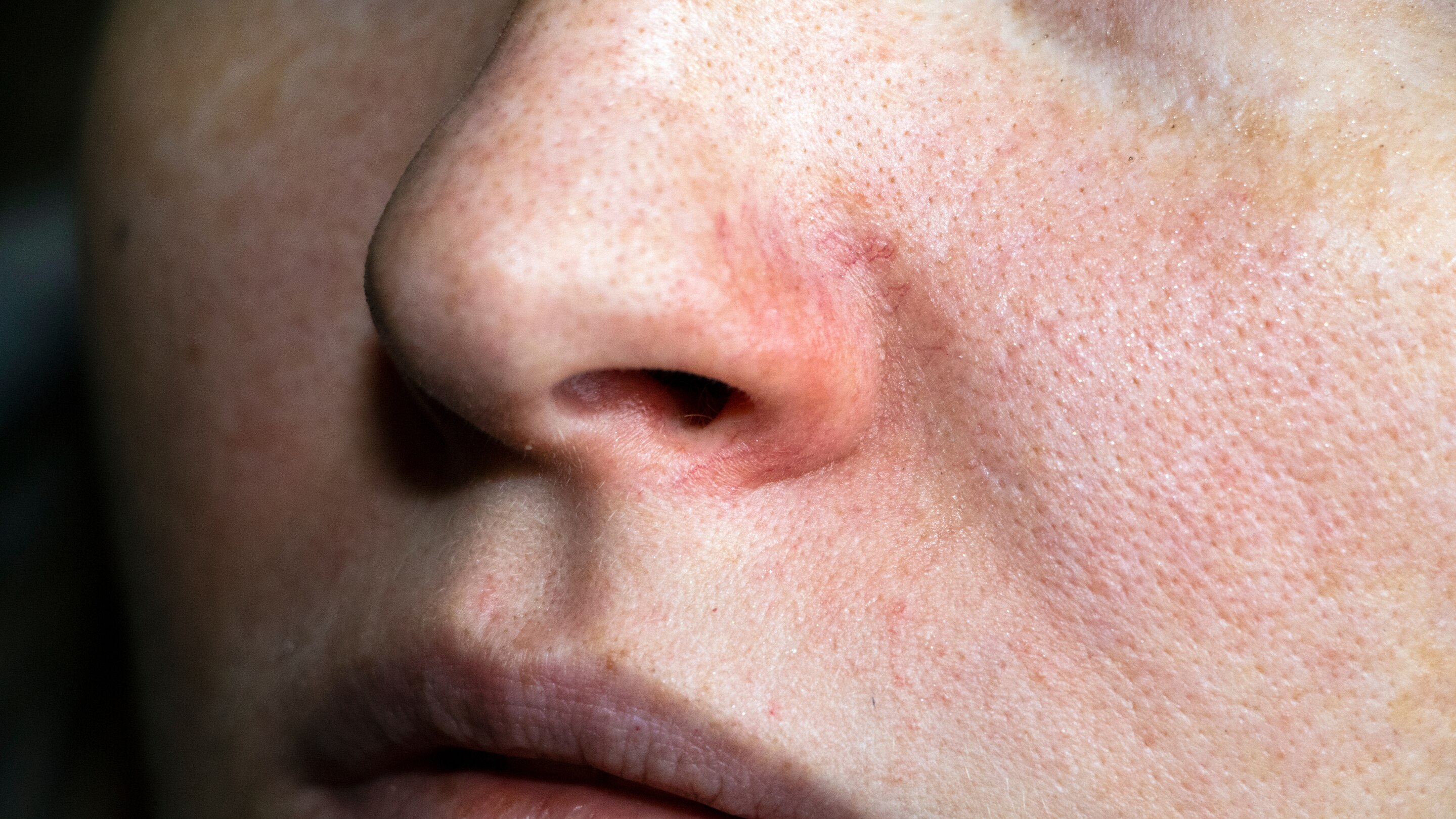 Helps improve the appearance of pores: