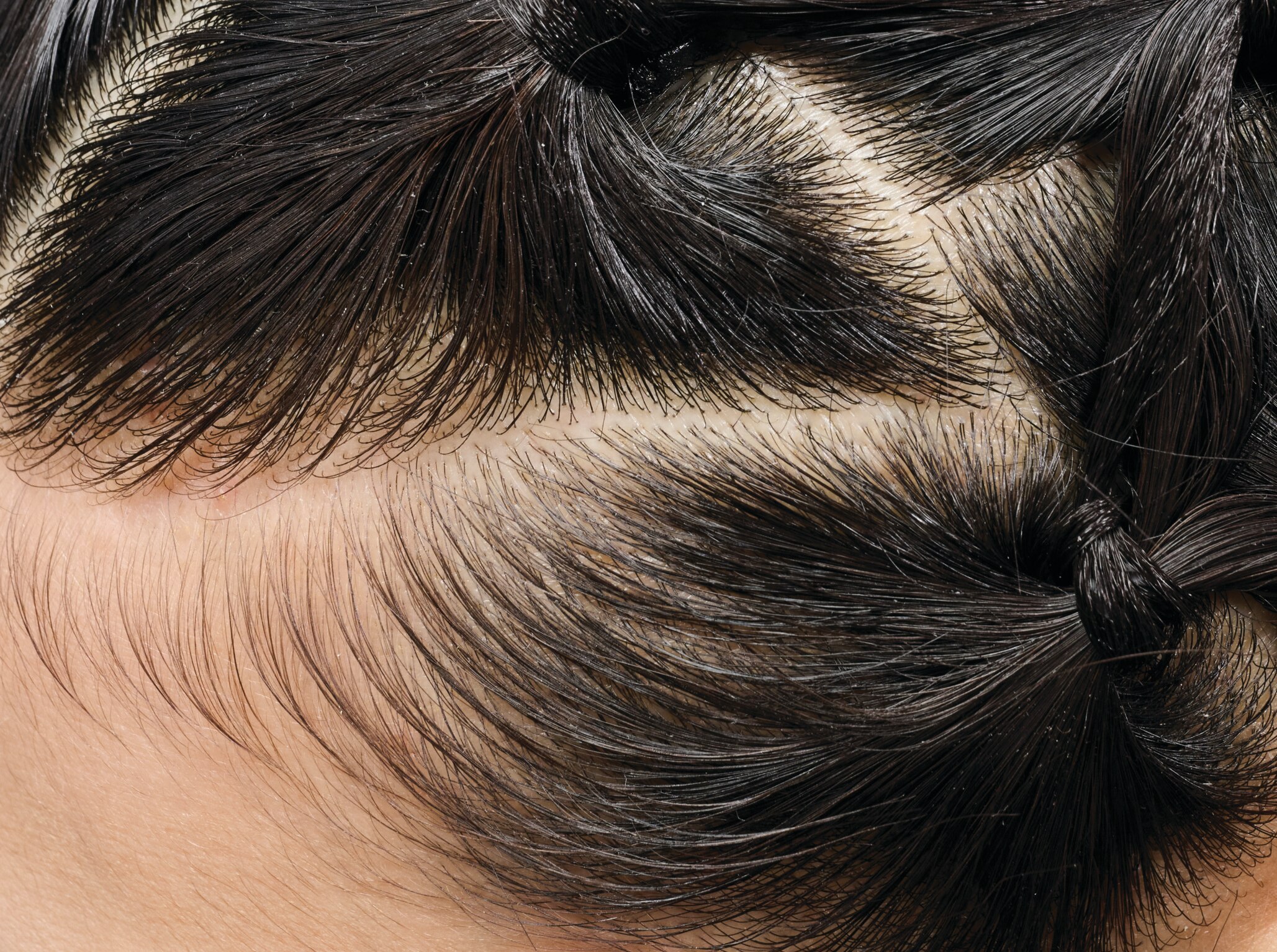What is The Scalp Microbiome And Why Does It Matter for Your Hair?