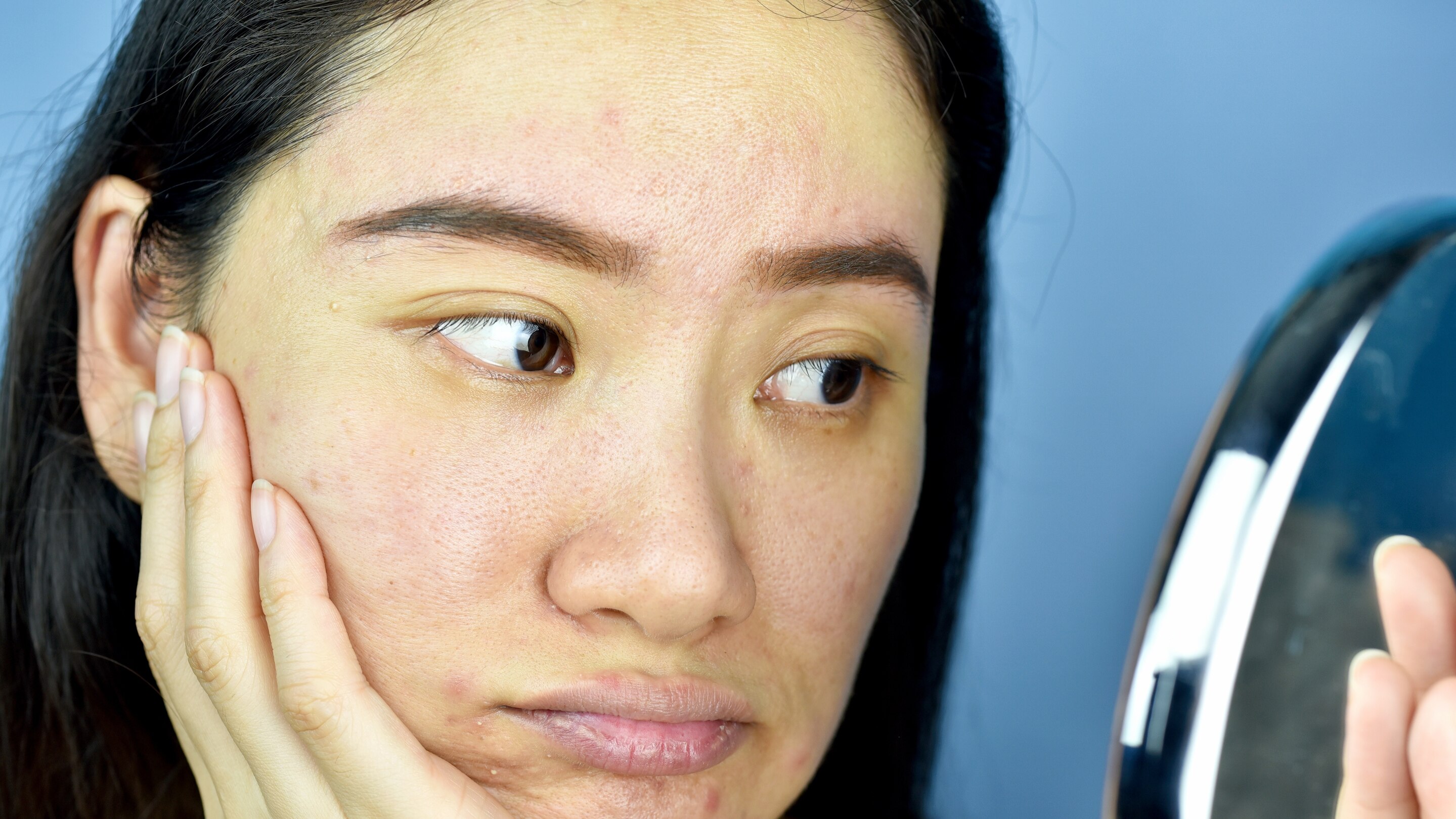 Dull or Uneven Skin Tone