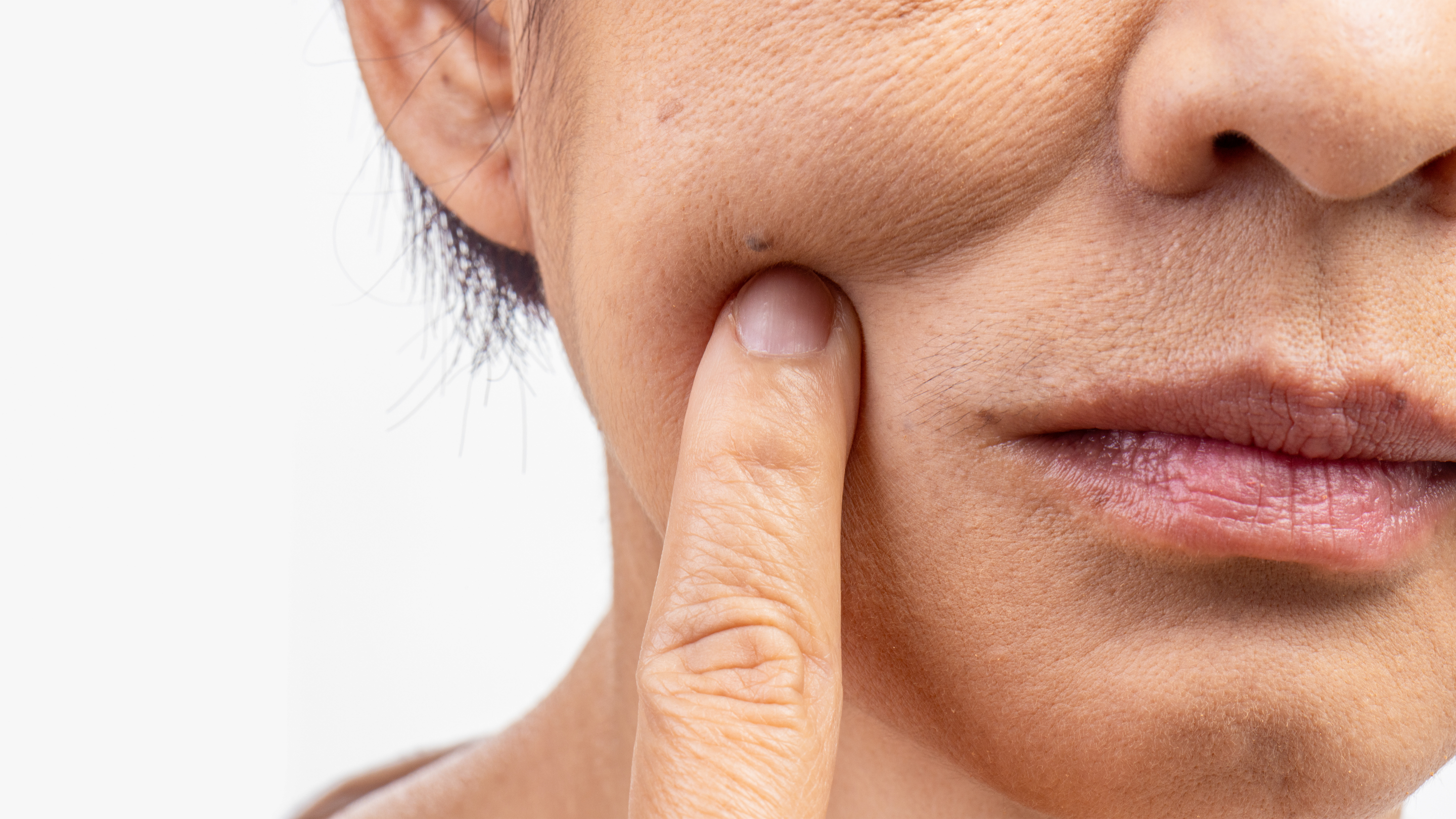 Dry and Sensitive Skin
