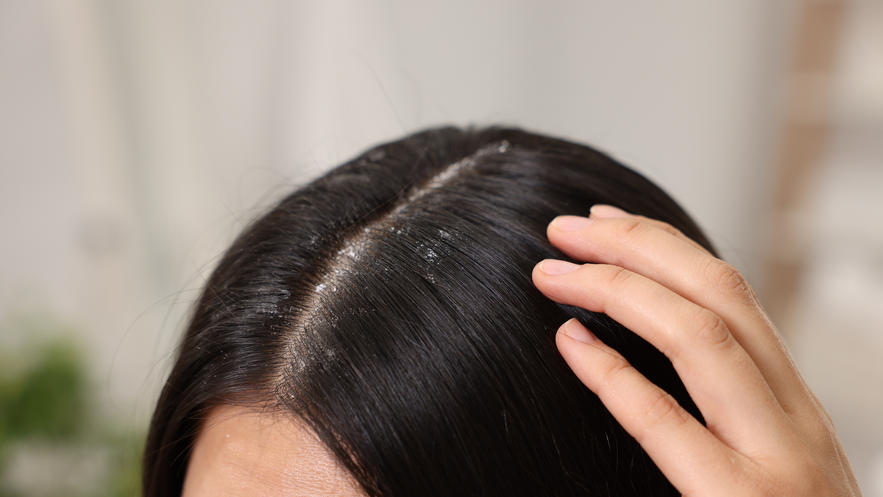 Dealing with Malassezia