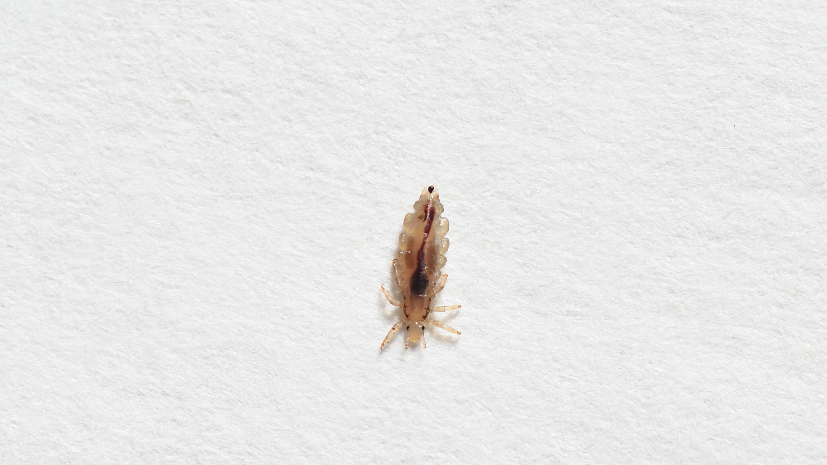 Head lice.