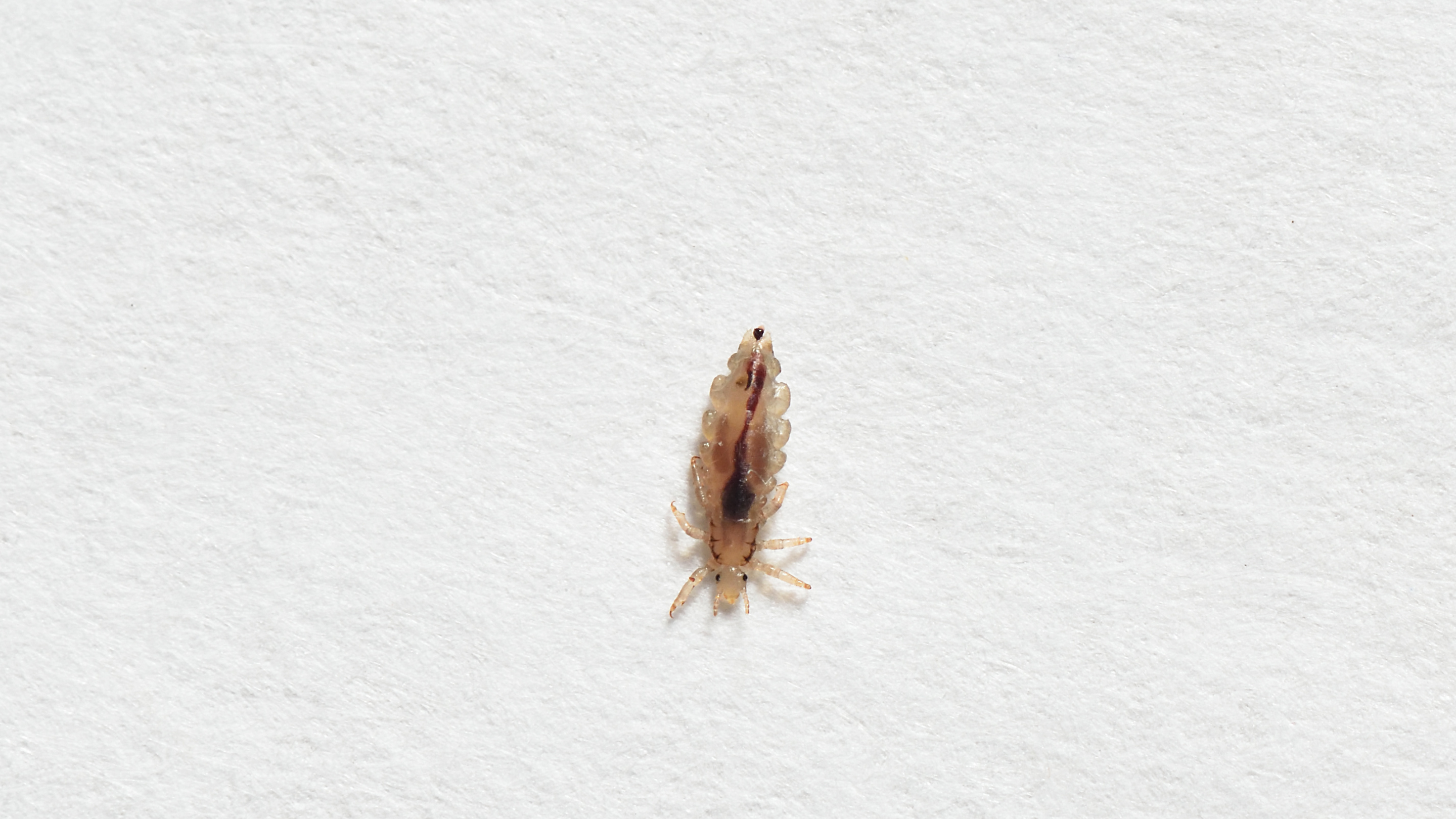 Head lice.