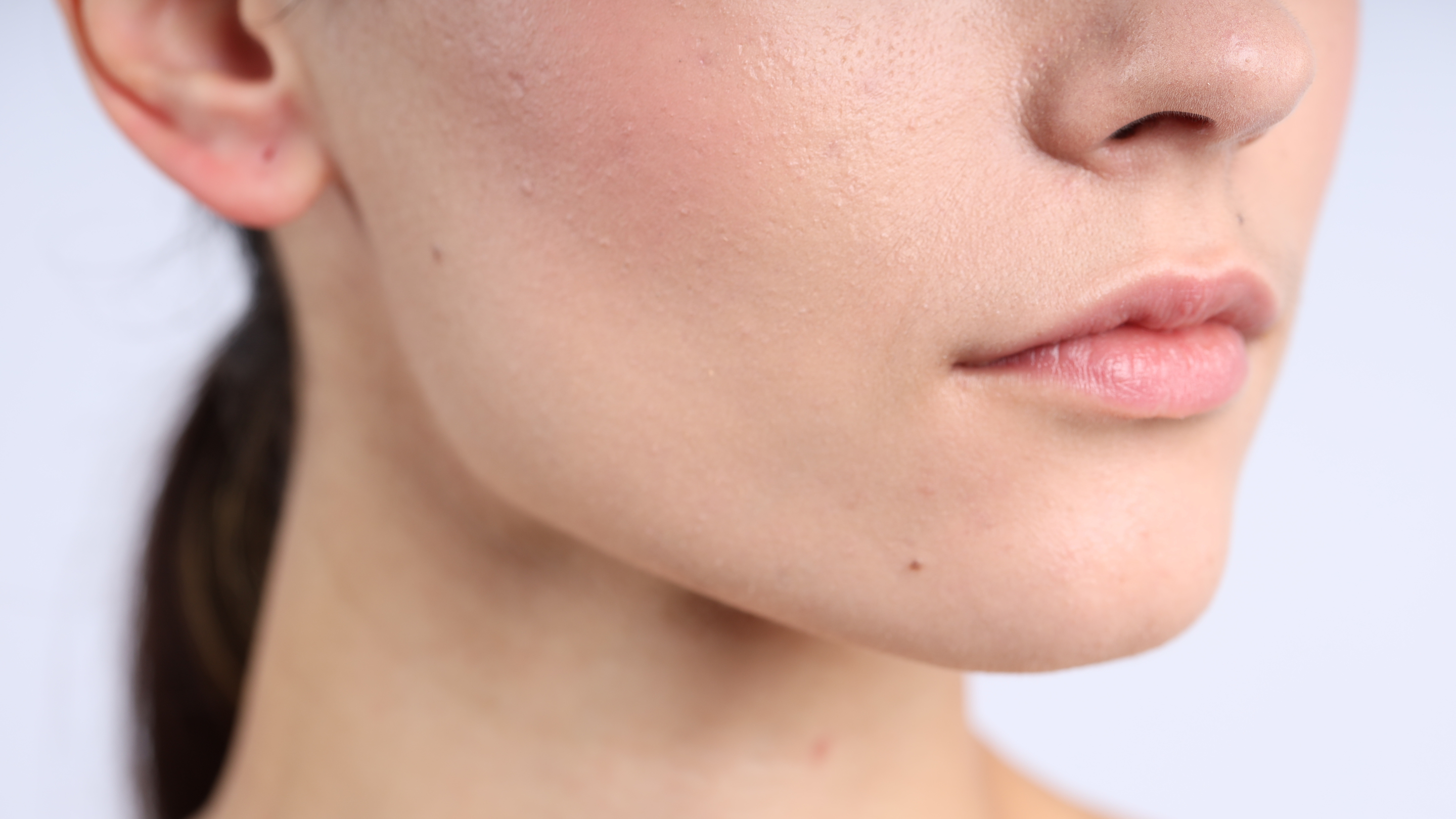 Sensitive Normal Skin