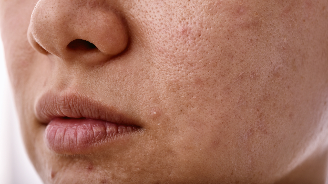 For Sensitive Skin