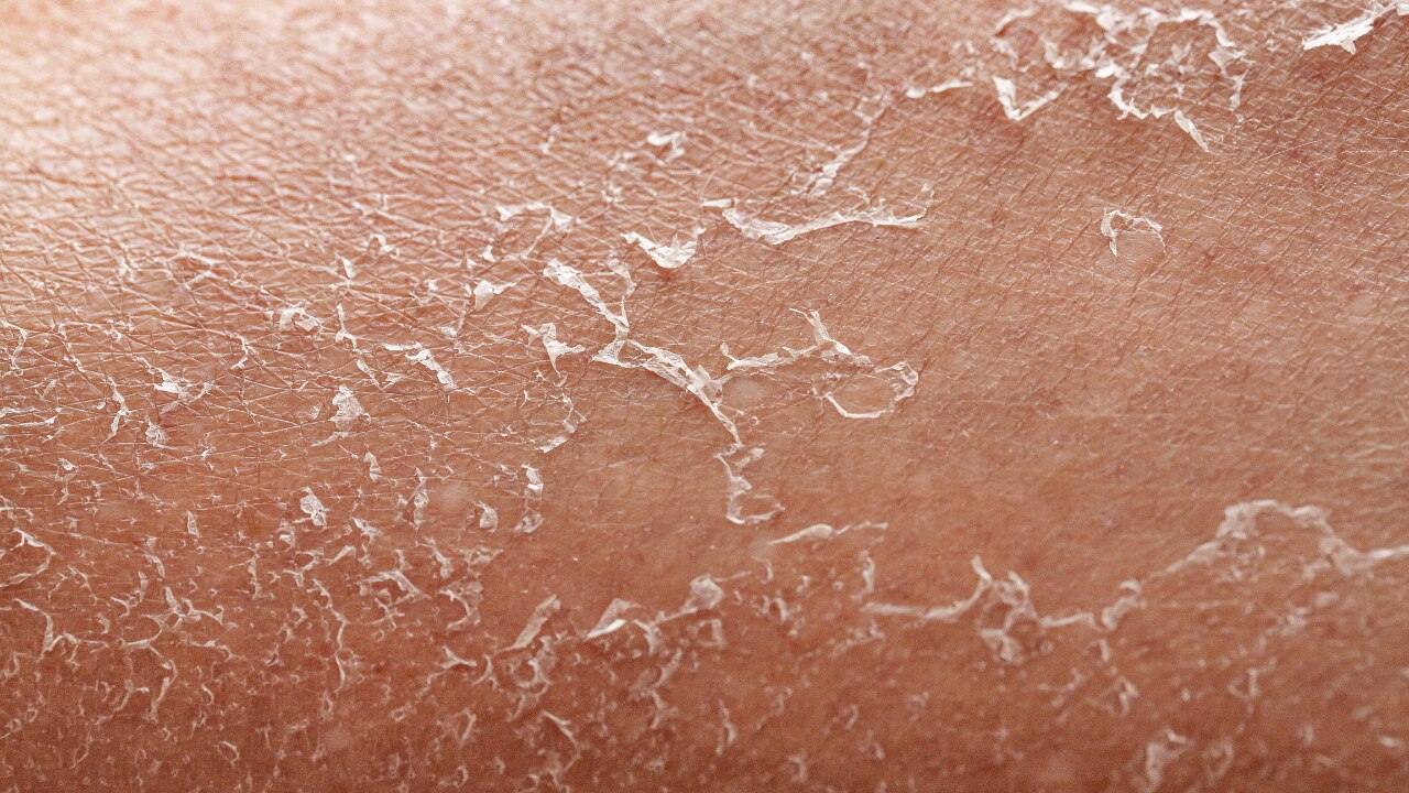 Relieves Dryness and Tightness