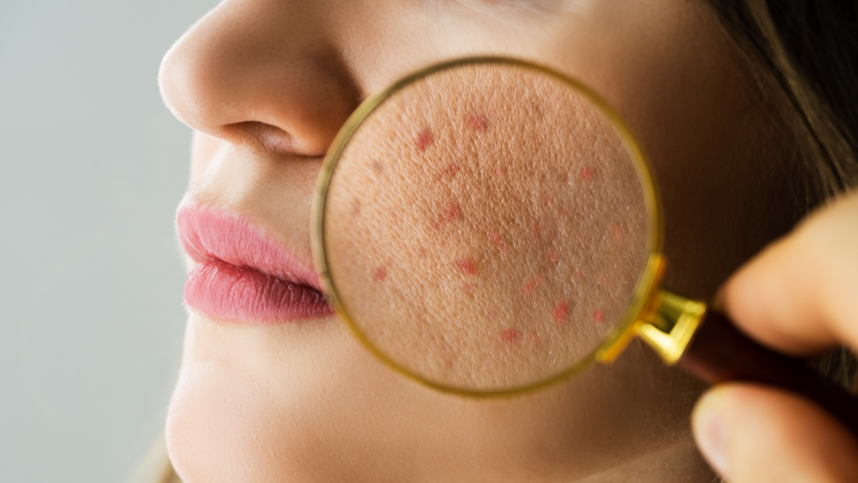 Signs of a Damaged Skin Barrier