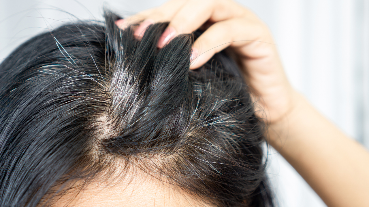 Is there any chance of reversing grey hair?