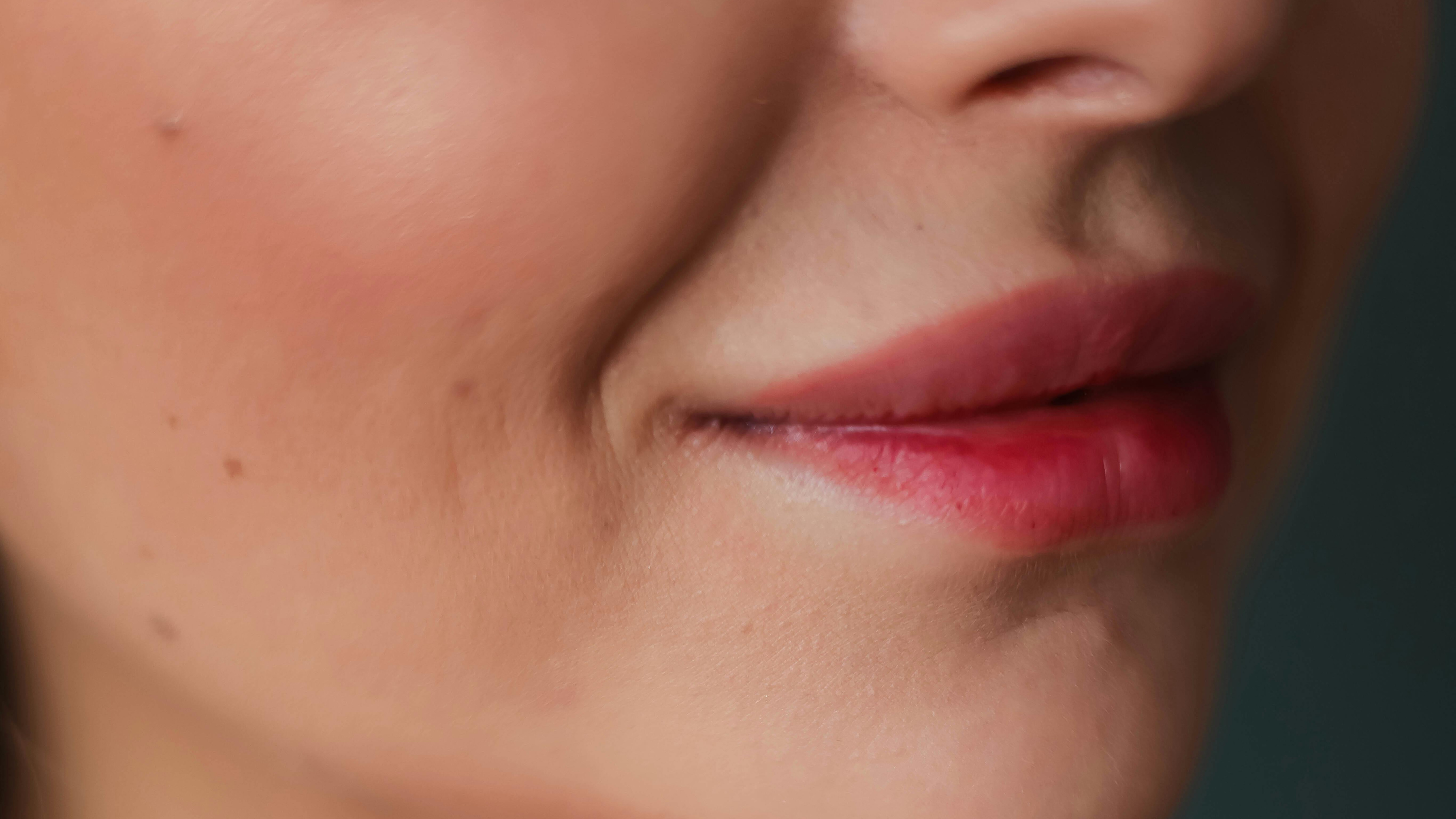 Why Does Skin Need Collagen?