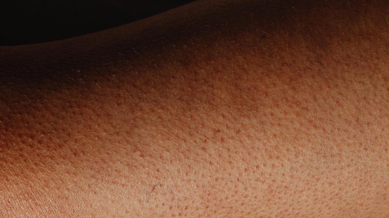 Darkening of the skin
