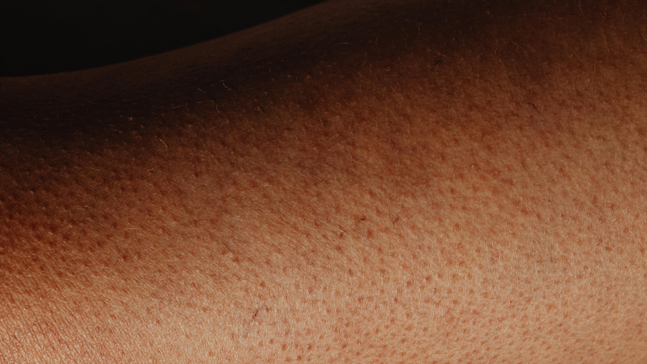 Darkening of the skin