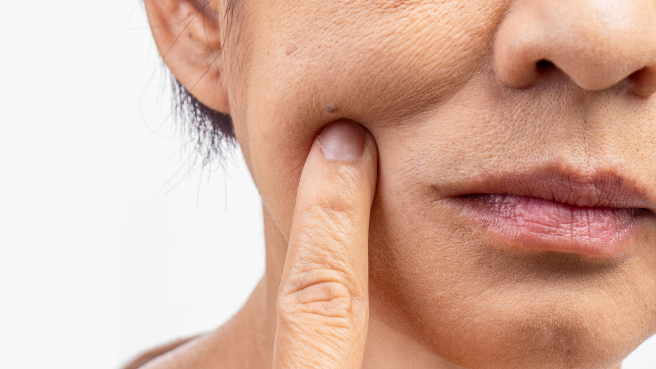 Mature Skin