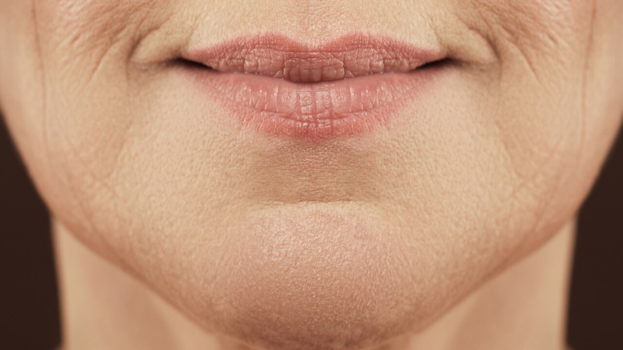 Fine Lines and Early Ageing