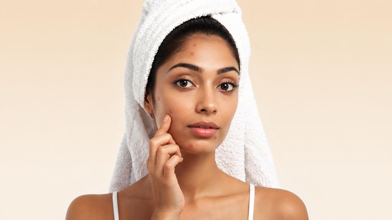 Oily and Acne-Prone Skin