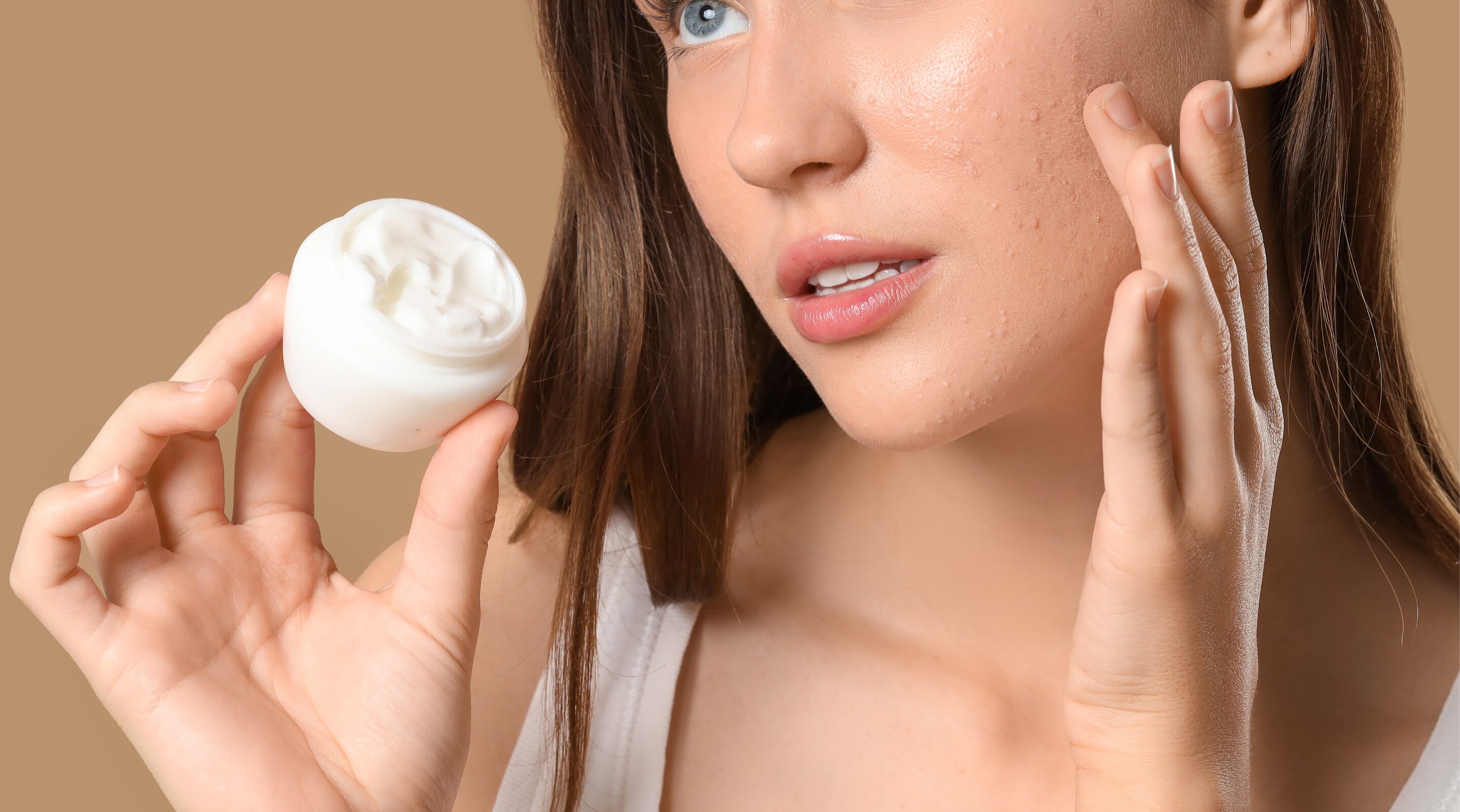 Pimple and Dark Spot Removal Cream for Clearer-Looking Skin