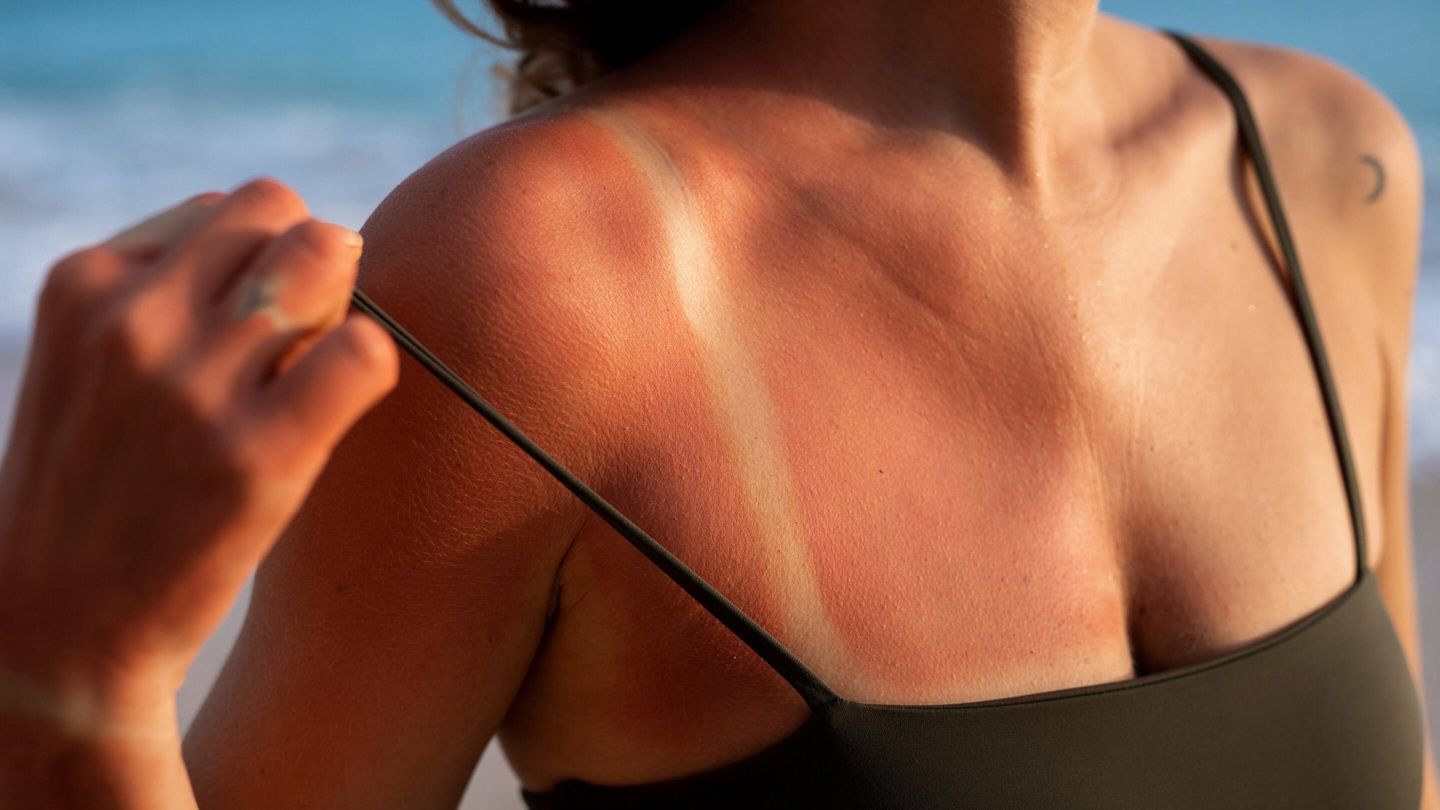 What Causes Skin Tan?