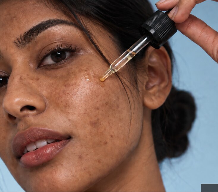 Image of Salicylic Acid vs Niacinamide vs Alpha Arbutin for Acne Spots in India