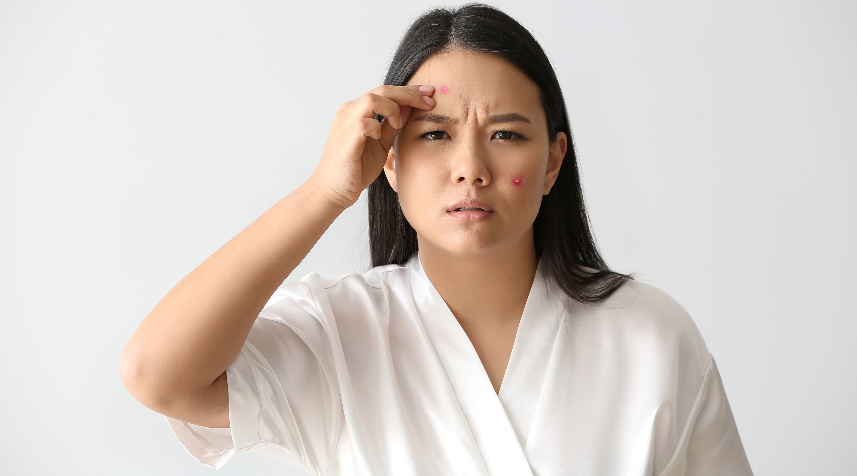 Acne Spot Treatments for Active Pimples