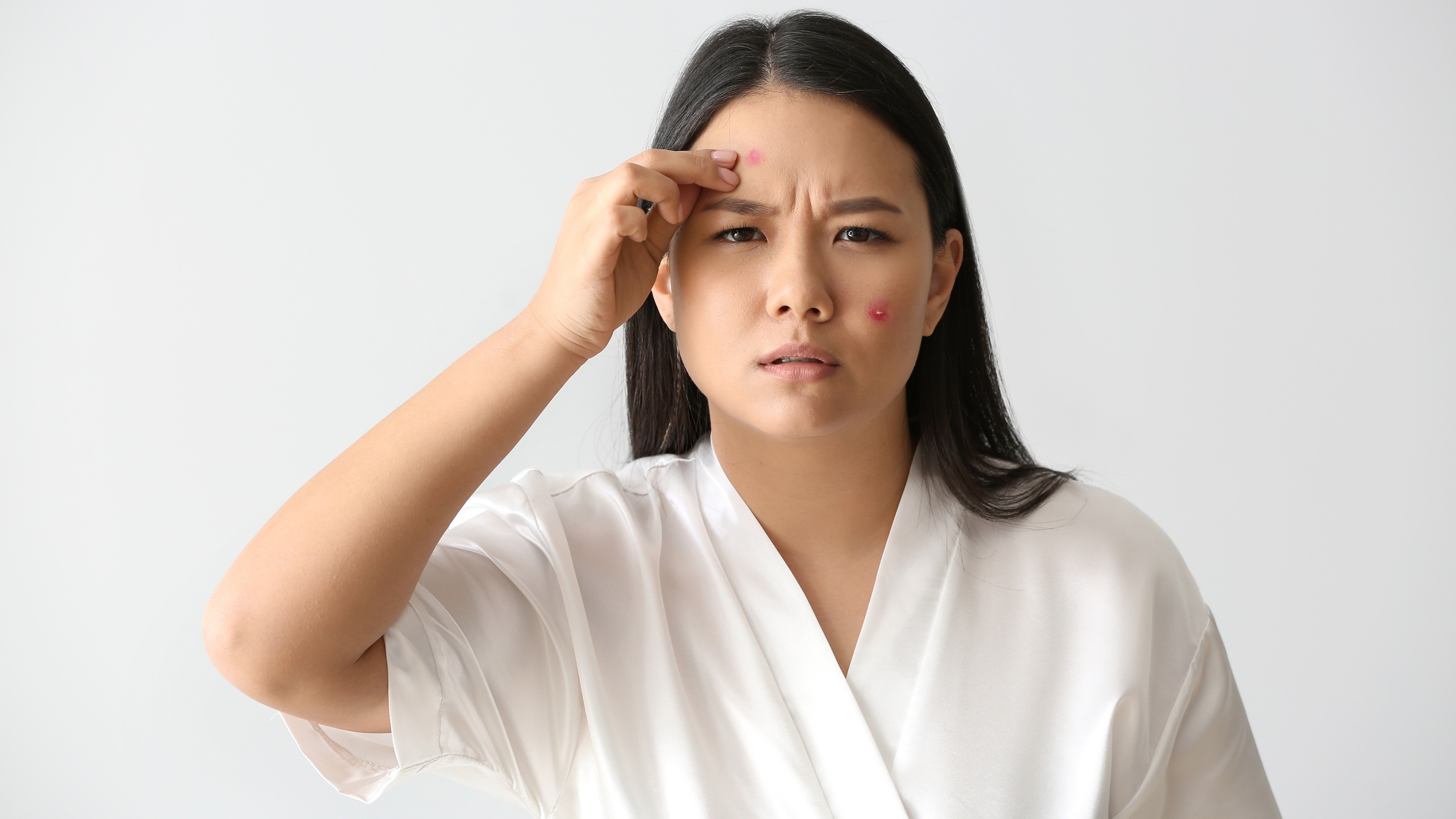 Acne Spot Treatments for Active Pimples