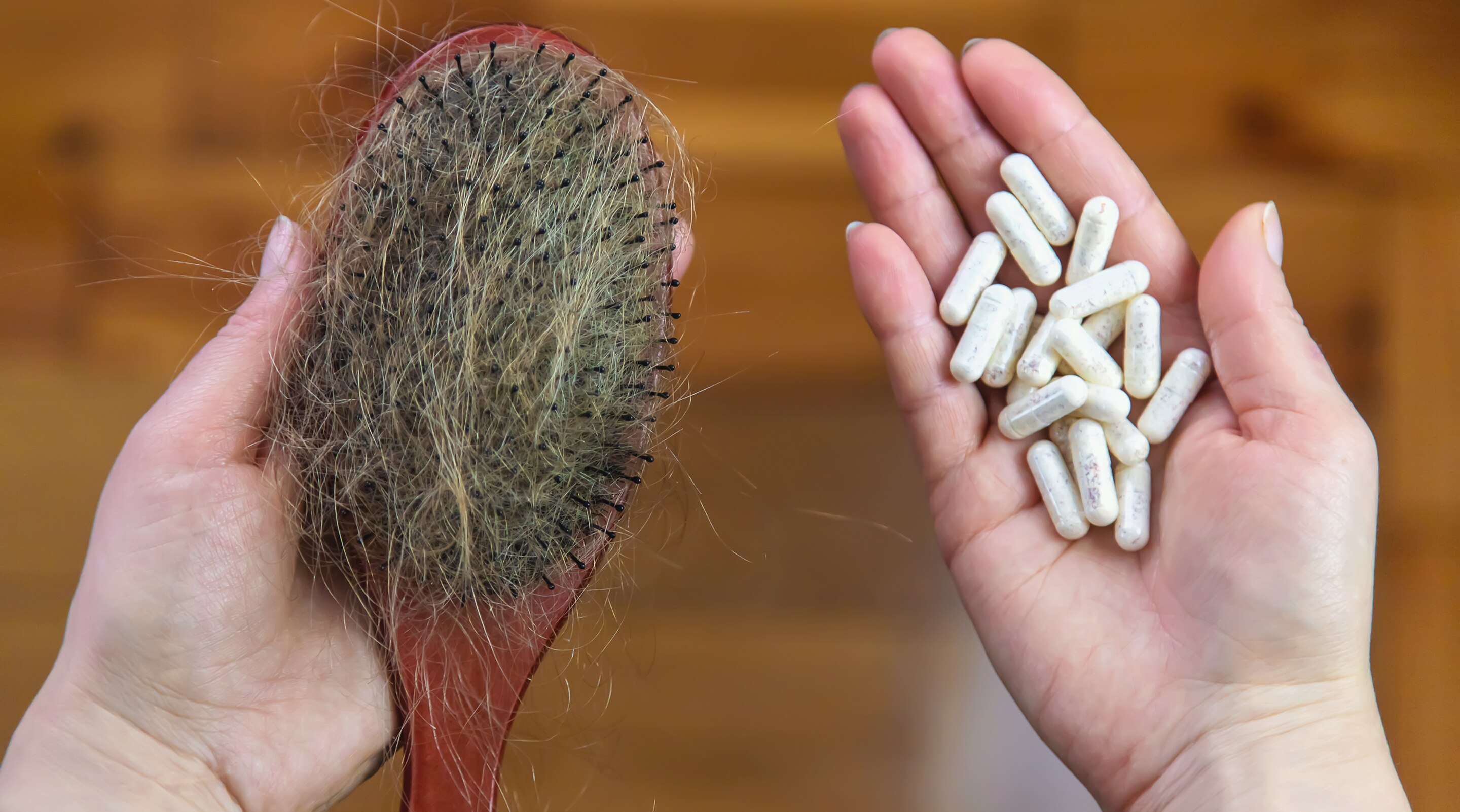 Hair Vitamins for Hair Fall Including Biotin Zinc and Iron