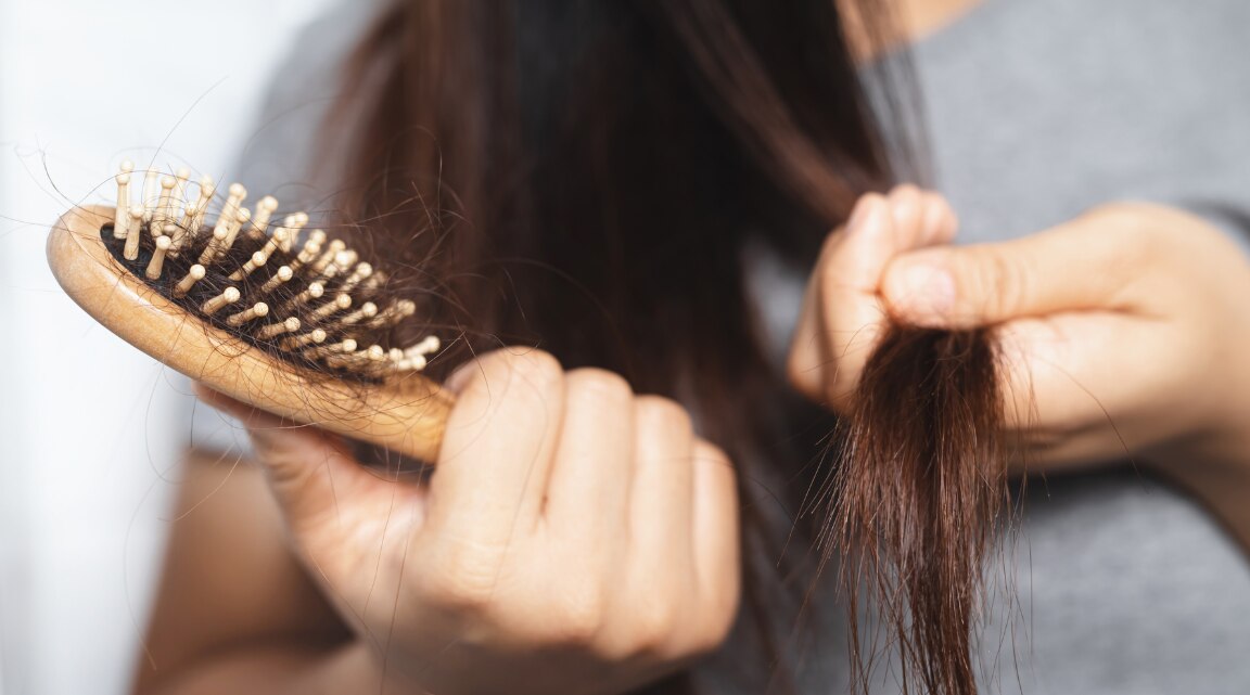 Hair Fall Caused by Biotin Iron and Zinc Gaps