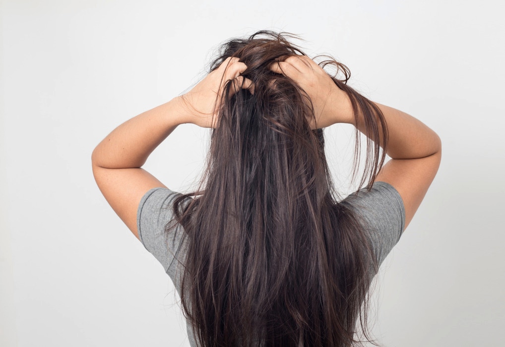 Itchy Scalp, Dry Scalp, and Sensitive Scalp