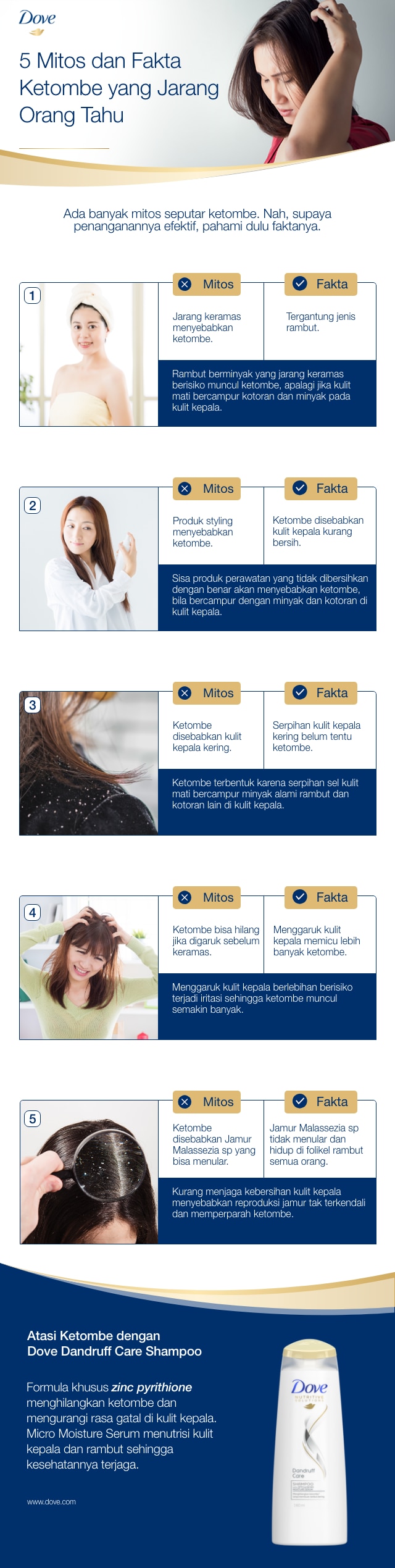 5 Mitos dan Fakta Ketombe yang Jarang Orang Tahu