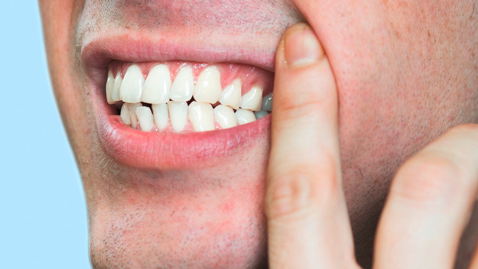 homme qui montre avec doigt dents et gencives douloureuses