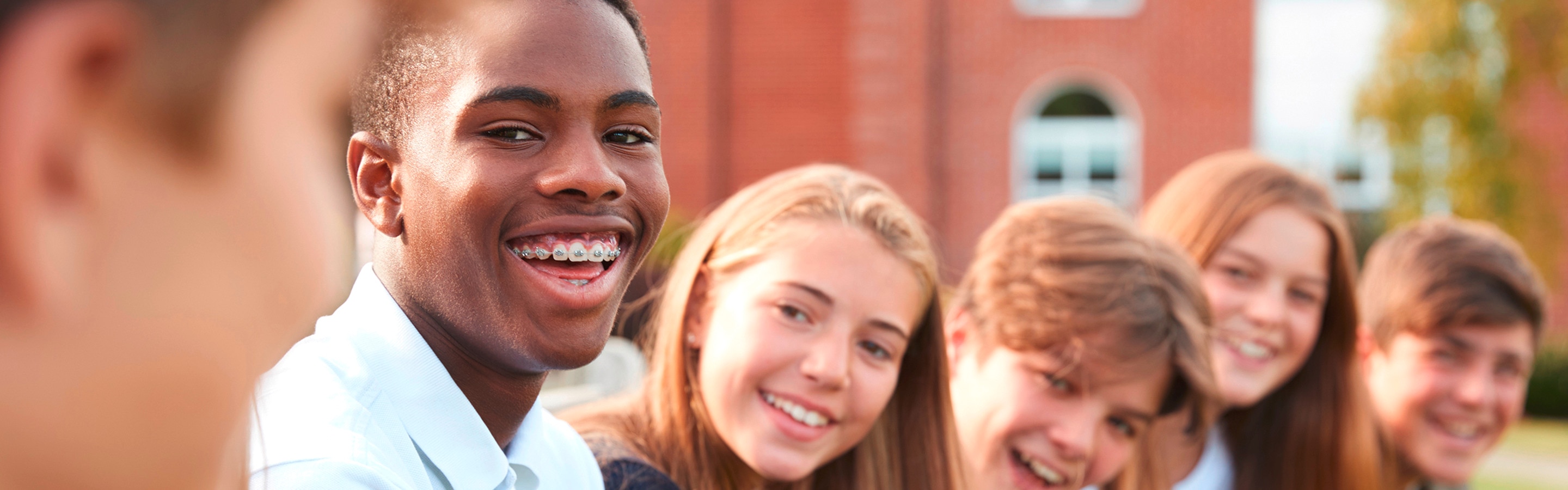 everything you need to know about braces