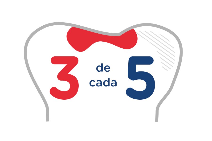 Imagen de un diente con carie 