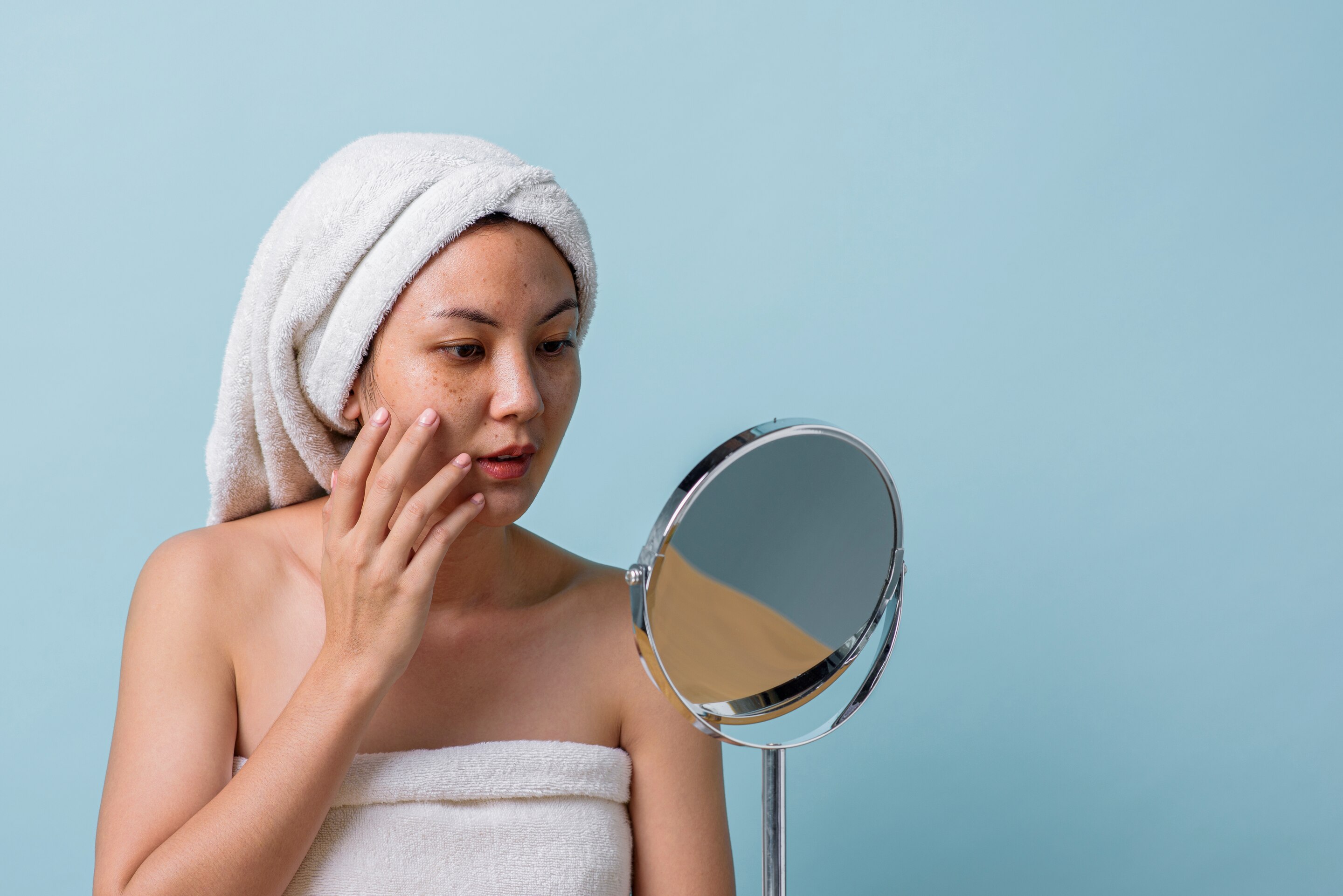 Asian woman with melasma touches her face in front of a mirror