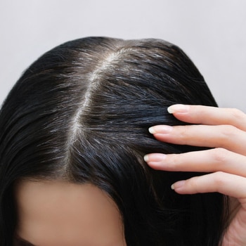 shampo untuk kepala apek